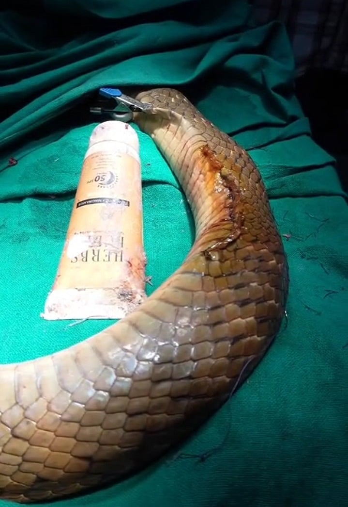 ಚಿತ್ರದುರ್ಗ: ಟ್ಯೂಬ್‌ ನುಂಗಿದ್ದ ಹಾವಿಗೆ ಯಶಸ್ವಿ ಶಸ್ತ್ರಚಿಕಿತ್ಸೆ