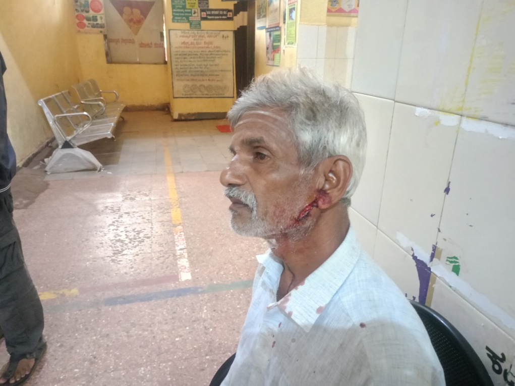 ಮಂಗನಿಂದ ಗಾಯಗೊಂಡವರು