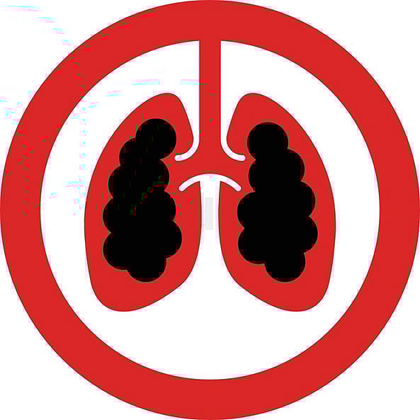 ರಾಜ್ಯ ಕ್ಷಯರೋಗ ನಿವಾರಣಾ ಸಂಸ್ಥೆ ವಿಲೀನ