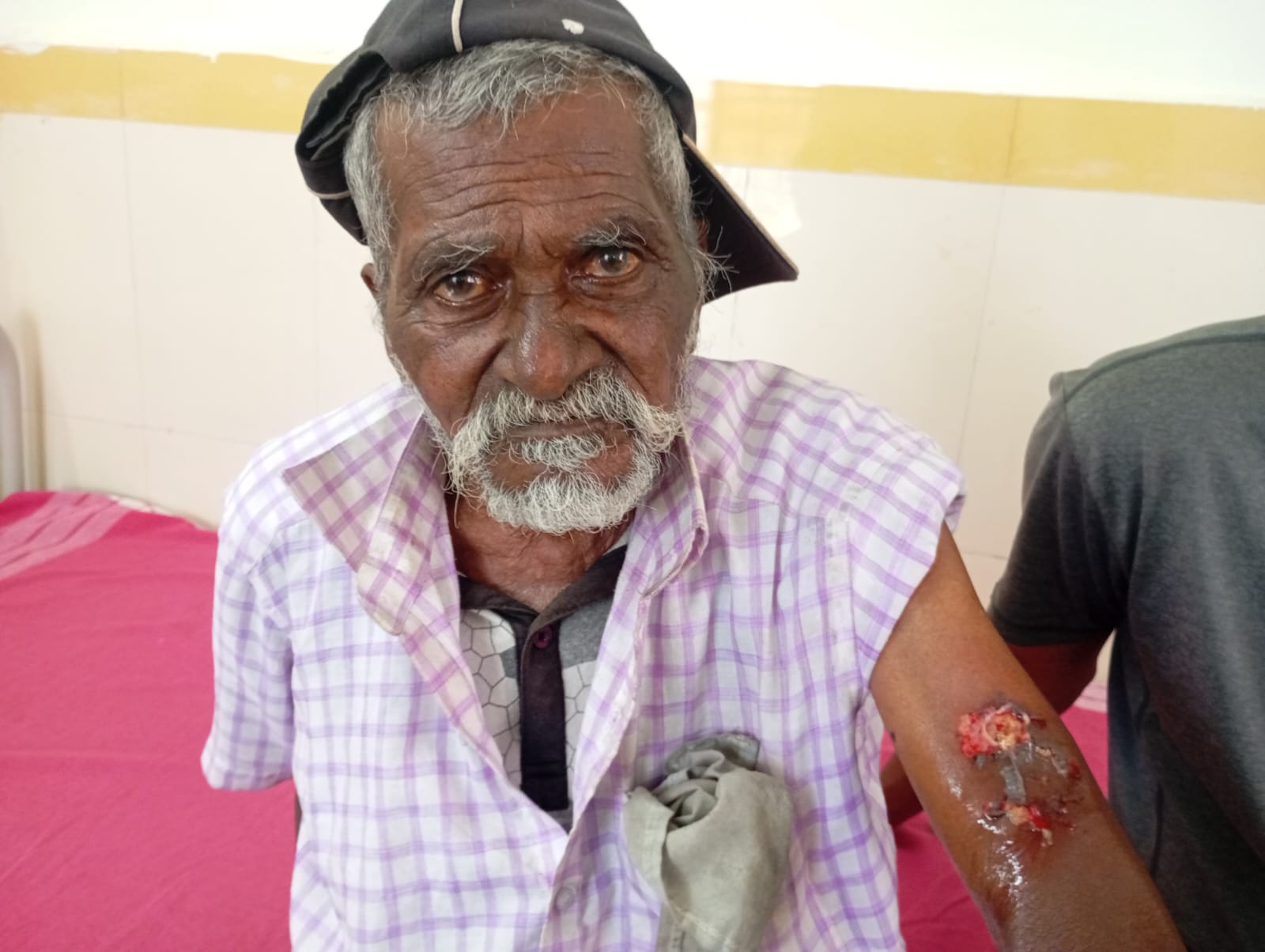 ಭಾಲ್ಕಿ ತಾಲ್ಲೂಕಿನ ಕಣಜಿ ಗ್ರಾಮದಲ್ಲಿ ಹುಚ್ಚು ನಾಯಿ ಕಡಿತಕ್ಕೆ ಒಳಗಾಗಿರುವ ವಯೋವೃದ್ಧ