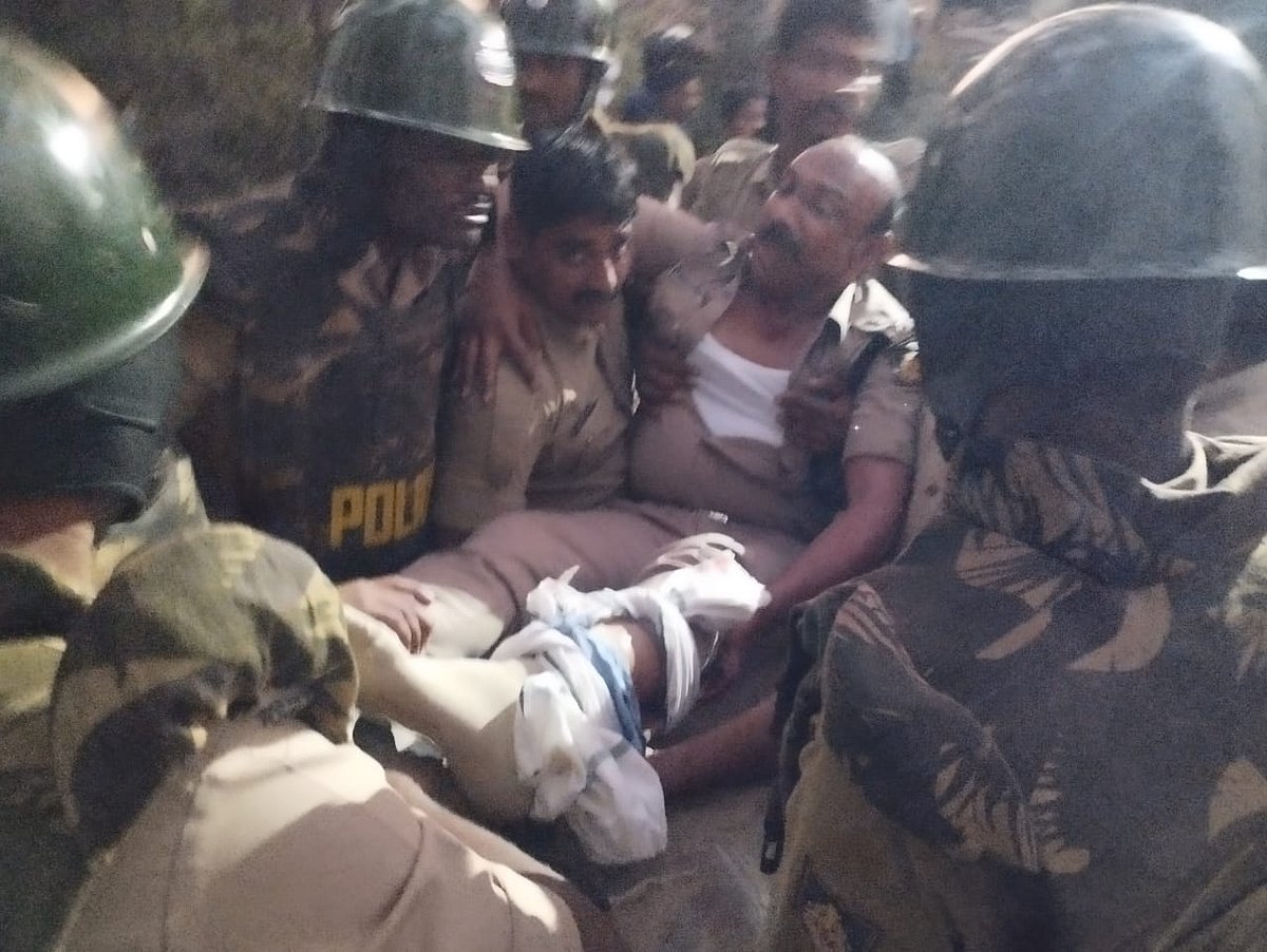 ಬಾಗಲಕೋಟೆ: ಕಲ್ಲು ತೂರಾಟದ ವೇಳೆ ASPಗೆ ಗಾಯ; ಹೆಚ್ಚಿನ ಚಿಕಿತ್ಸೆಗಾಗಿ ಬೆಂಗಳೂರಿಗೆ