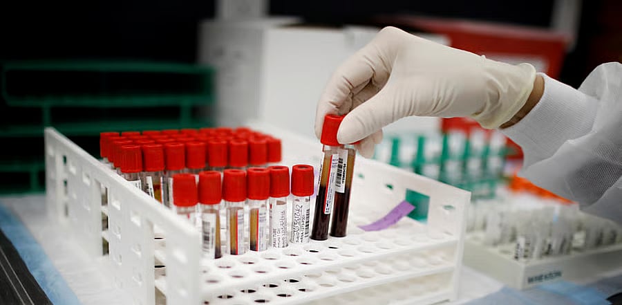 ರಕ್ತಕ್ಯಾನ್ಸರ್‌: ಮಿಥ್ಯೆ ಅರಿಯಿರಿ..ಡಾ. ಅಭಿಷೇಕ್ ಧೂಧಾತ್ರ ಅವರ ಲೇಖನ