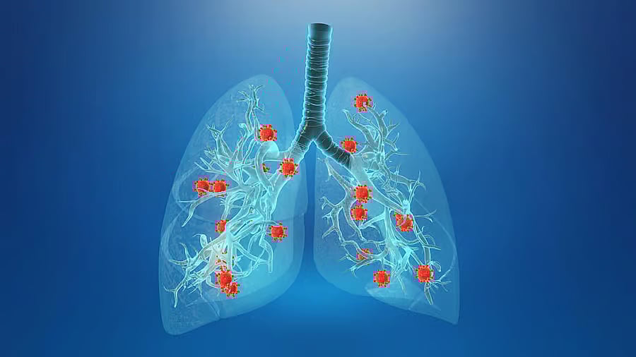 ಶ್ವಾಸಕೋಶದ ಆರೋಗ್ಯ: ಉಸಿರಾಟ ಸಮಸ್ಯೆಯ ಮುಕ್ತಿಗೆ ಸಲಹೆಗಳು