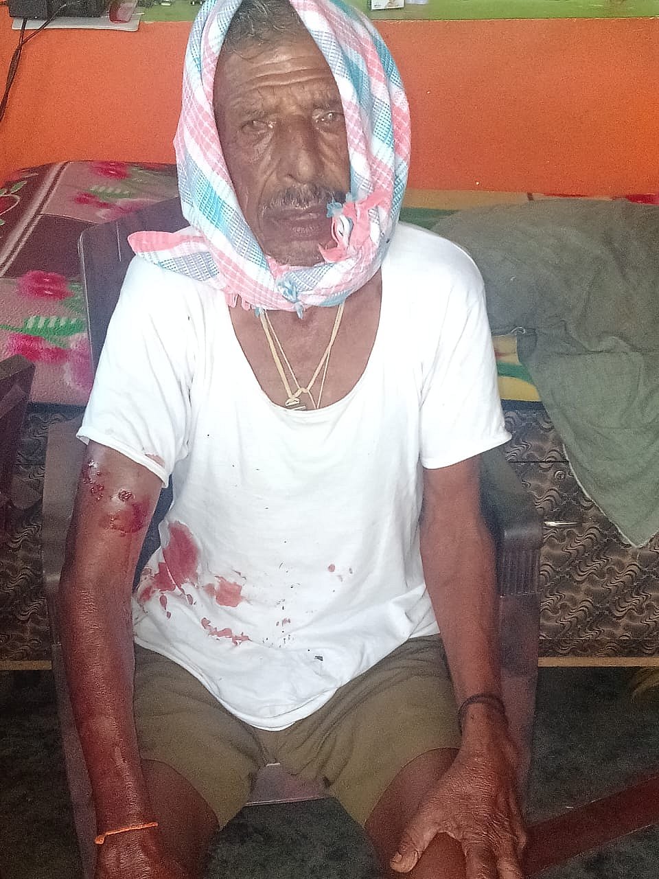 ಮಾಗಡಿ | ಸಾಕು ನಾಯಿಗಳ ದಾಳಿ: ವ್ಯಕ್ತಿಗೆ ಗಾಯ 