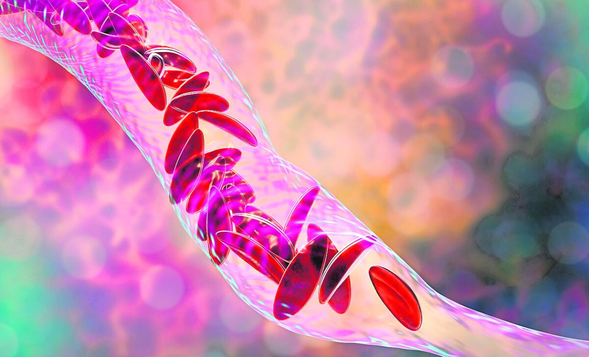  ಪಪ್ಪಾಯ ಹಣ್ಣಿನ ಸೇವನೆಯು  ಪ್ಲೇಟ್ಲೆಟ್‌ ಗ ಳನ್ನು ಸಮತೋಲನದಲ್ಲಿ ಇರಿಸುತ್ತದೆ. 