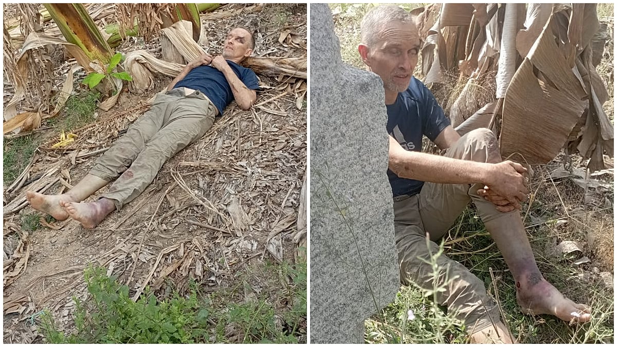 ಹಂಪಿ ಅಷ್ಟಭುಜ ಸ್ನಾನದ ಕೊಳದ ಬಳಿ ಗುಡ್ಡ ಏರುವಾಗ ಬಿದ್ದು ಫ್ರಾನ್ಸ್‌ ಪ್ರಜೆ ಫಜೀತಿ