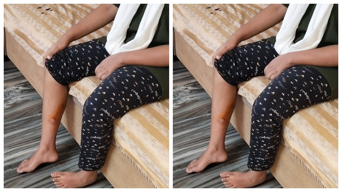 ಮತೀಯ ಗೂಂಡಾಗಿರಿ ಆರೋಪದಲ್ಲಿ ಎಫ್‌ಐಆರ್‌: ಗೋಮಾಂಸ ಸಾಗಿಸಿದವನ ವಿರುದ್ಧವೂ ಪ್ರಕರಣ