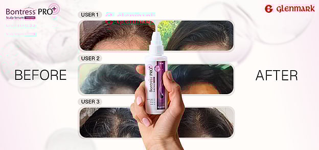 ಮನೆಮದ್ದುಗಳಾಚೆಗೆ ಯೋಚಿಸೋಣ: ಕೂದಲು ಉದುರುವಿಕೆಗೆ ನಿಜವಾದ ಪರಿಹಾರ ಯಾವುದು?