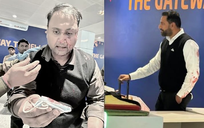 ಪ್ರಯಾಣಿಕನಿಗೆ ರಕ್ತ ಬರುವಂತೆ ಗಂಭೀರ ಹಲ್ಲೆ: ಏರ್ ಇಂಡಿಯಾ ಪೈಲಟ್‌ ಬಂಧನ