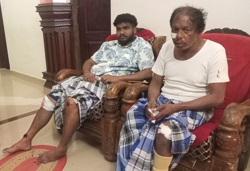 ಸಿದ್ದಾಪುರ| ಕಾಡು ಹಂದಿಗಳ ಹಾವಳಿ: ವಾಹನ ಸವಾರರಿಗೆ ಗಾಯ