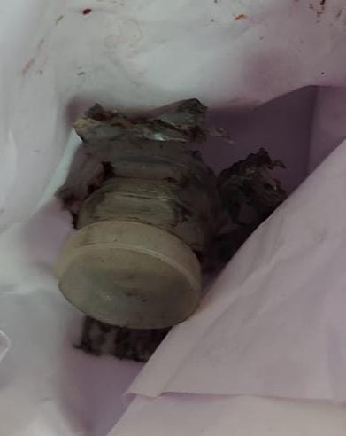 ಬಳ್ಳಾರಿಯಲ್ಲಿ ಜ.1ರಂದು ಸಂಭವಿಸಿದ್ದ ದೊಂಬಿ ಪ್ರಕರಣದಲ್ಲಿ ಮೃತಪಟ್ಟಿದ್ದ ರಾಜಶೇಖರ ಅವರ ದೇಹದಲ್ಲಿ ಪತ್ತೆಯಾಗಿದೆ ಎನ್ನಲಾದ ಬಂದೂಕಿನ ವಸ್ತು (ವ್ಯಾಡ್‌)