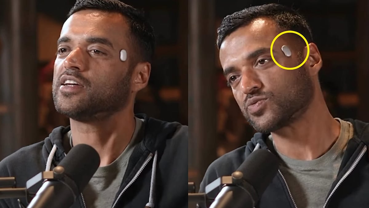 ಜೊಮಾಟೊ ಸಂಸ್ಥಾಪಕ ದೀಪಿಂದರ್ ಗೋಯಲ್ ಹಣೆಯ ಮೇಲಿದೆ ಚಿಕ್ಕ ಸಾಧನ: ಏನಿದು ಟೆಂಪಲ್?