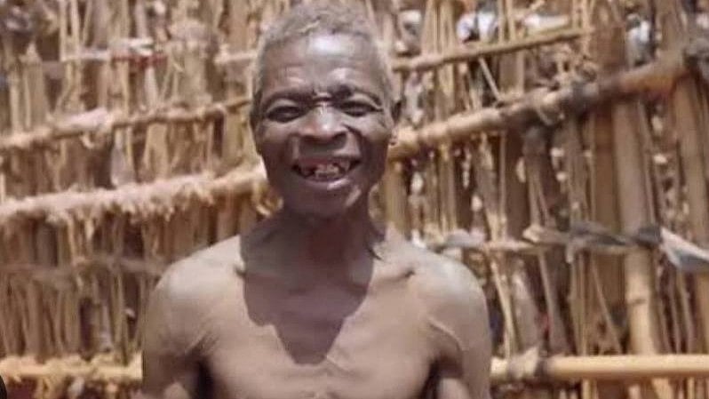 ಹೆಣ್ಣೆಂದರೇ ಬೆಚ್ಚಿ ಬೀಳುವ ಈತ 56 ವರ್ಷದಿಂದ ಒಂಟಿ, ಏನಿದು ಸಮಸ್ಯೆ?! 