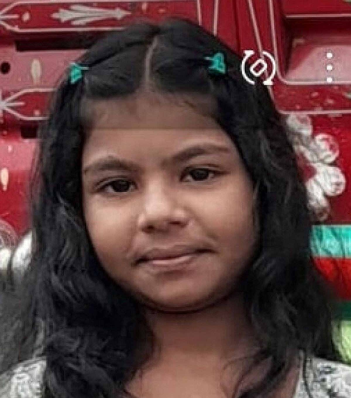 ಬಾಗಲಕೋಟೆ | ಬೀದಿ ನಾಯಿ ಕಚ್ಚಿ ಬಾಲಕಿ ಸಾವು