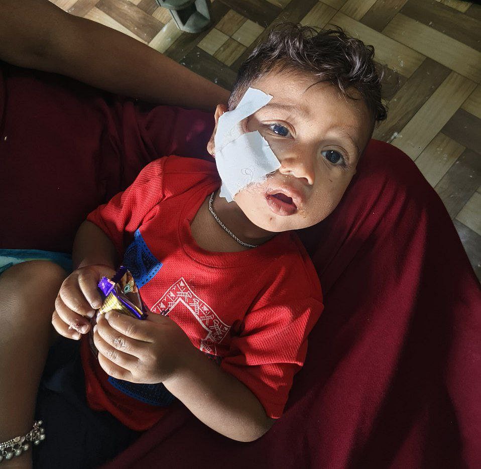 ಚಿಕ್ಕೋಡಿ | 2 ವರ್ಷದ ಮಗು ಮೇಲೆ ಬೀದಿ ನಾಯಿ ದಾಳಿ