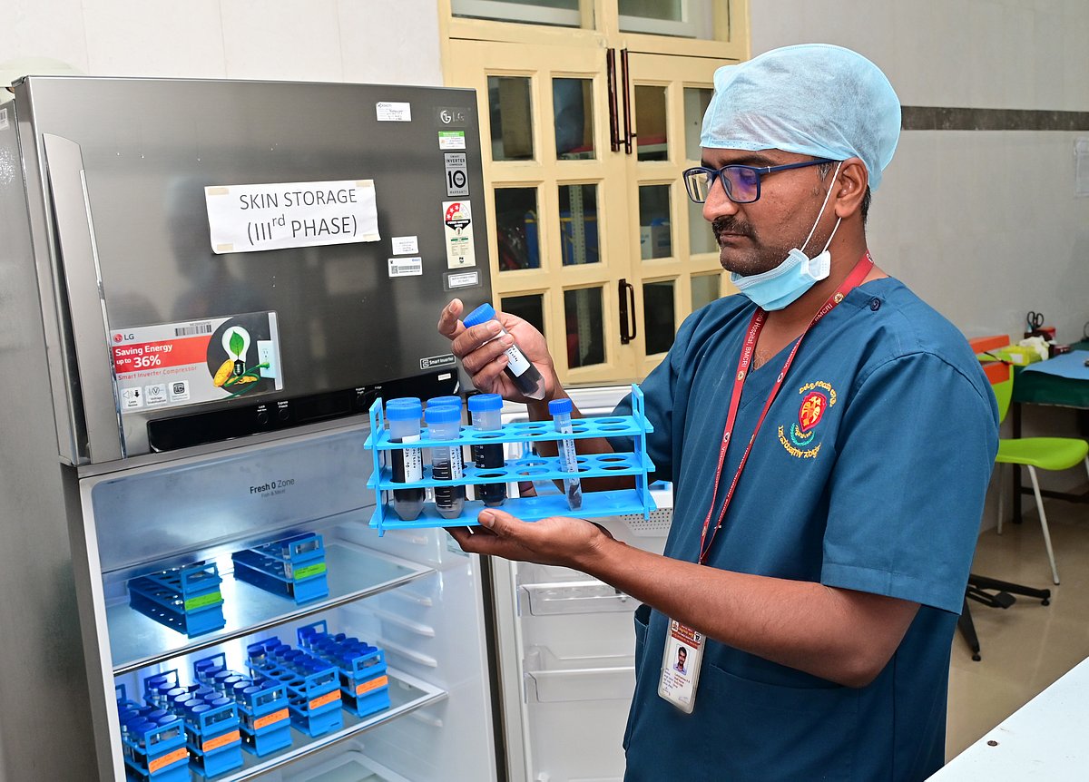 ಗಾಯಾಳು ಆರೈಕೆಗೆ ಬೇಕು ಮೃತರ ಚರ್ಮ: ದಾನಿಗಳಿಗಾಗಿ ಕಾಯುತ್ತಿದೆ ಸ್ಕಿನ್ ಬ್ಯಾಂಕ್