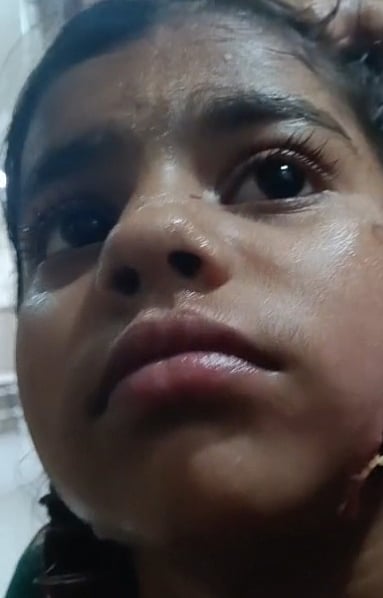 ಹಾರೋಹಳ್ಳಿ: ಬಾಲಕಿ ಮೇಲೆ ಬೀದಿ ನಾಯಿ ದಾಳಿ