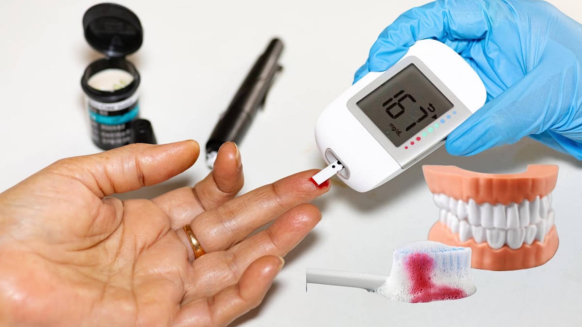 ಮಧುಮೇಹಿಗಳು ಬಾಯಿಯ ಆರೋಗ್ಯ ಕಾಪಾಡಿಕೊಳ್ಳುವುದು ಎಷ್ಟು ಮುಖ್ಯ ಗೊತ್ತಾ?