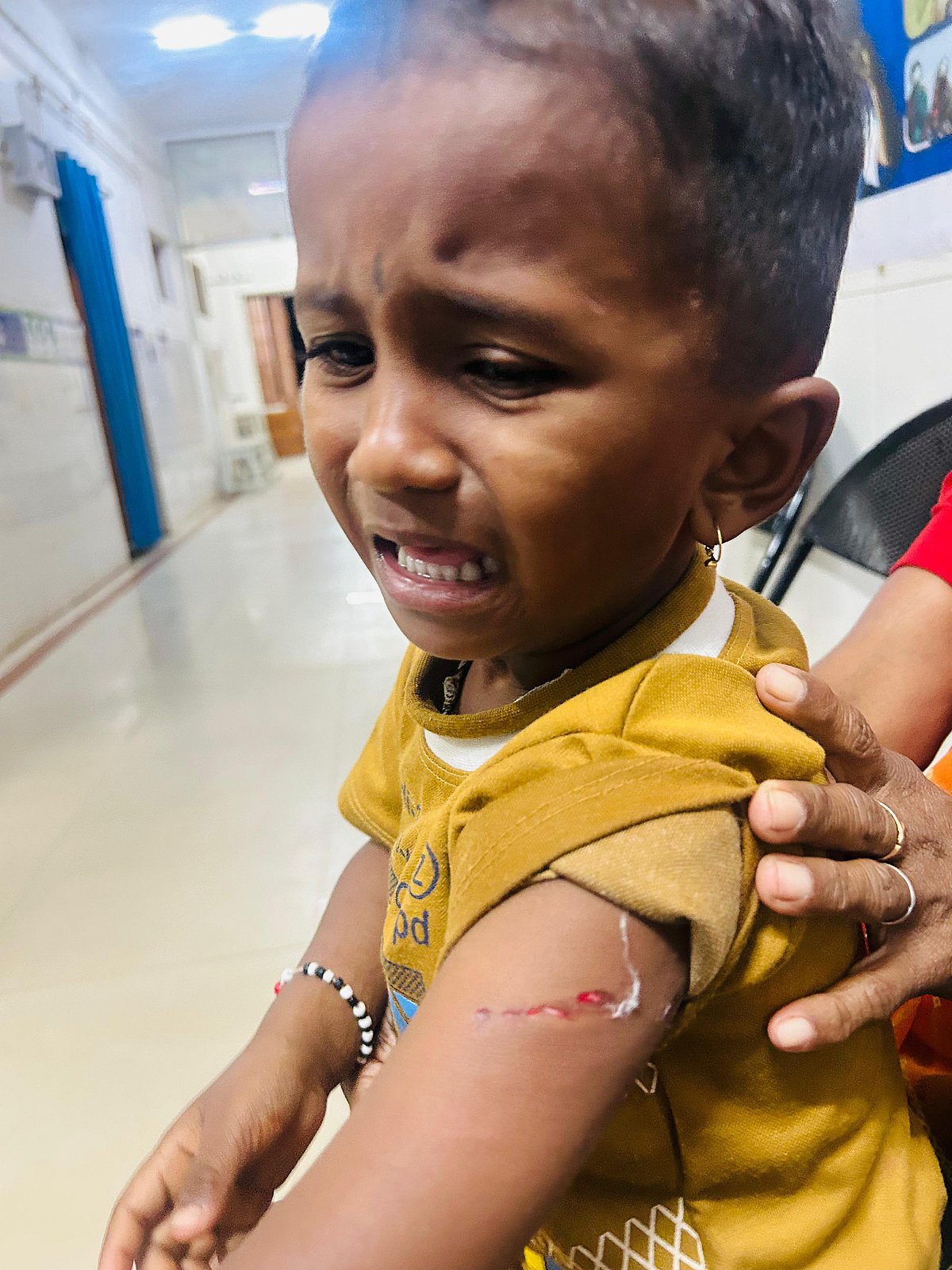 ಕನಕಗಿರಿ: ನಾಯಿ ಕಚ್ಚಿ 8 ಜನರಿಗೆ ಗಾಯ