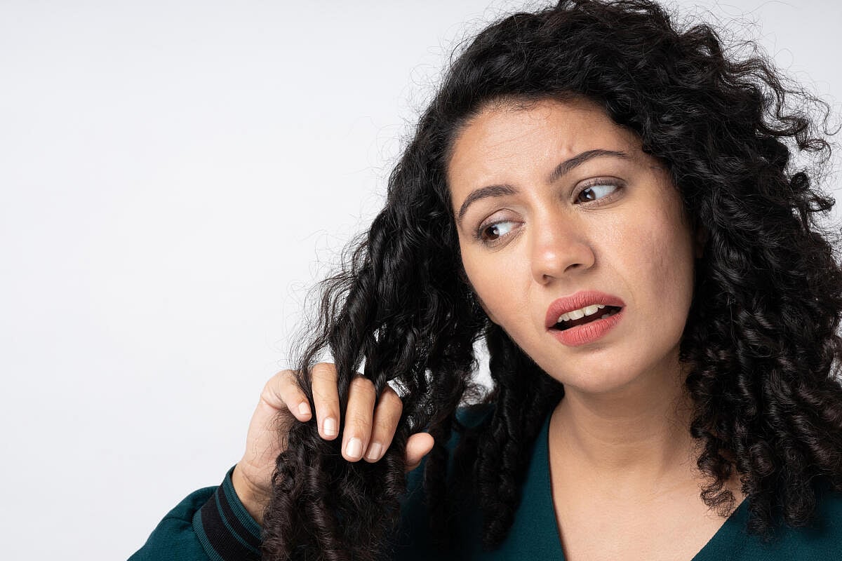 ಕ್ಷೇಮ–ಕುಶಲ: ತಲೆಹೊಟ್ಟಿನ ಗುಟ್ಟು ರಟ್ಟು