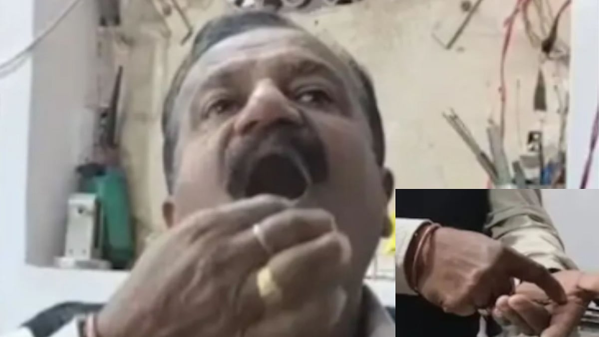 ಈ ವ್ಯಕ್ತಿಯ ಬಾಯಲ್ಲಿವೆ 150ಕ್ಕೂ ಹೆಚ್ಚು ಪಿನ್‌ಗಳು!