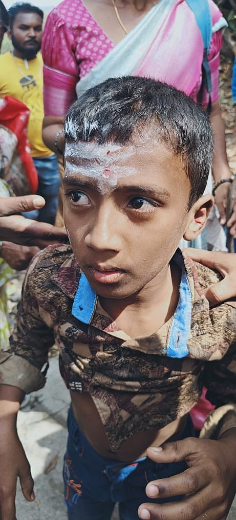 ಚಾಮರಾಜನಗರ: ಬಾಲಕನ ಮೇಲೆ ಚಿರತೆ ದಾಳಿ