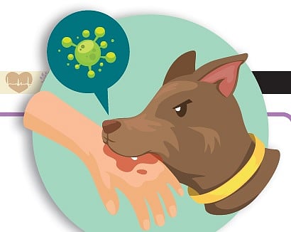 ಕ್ಷೇಮ–ಕುಶಲ: ರೇಬಿಸ್‌ ಮಾರಣಾಂತಿಕ ರೋಗ