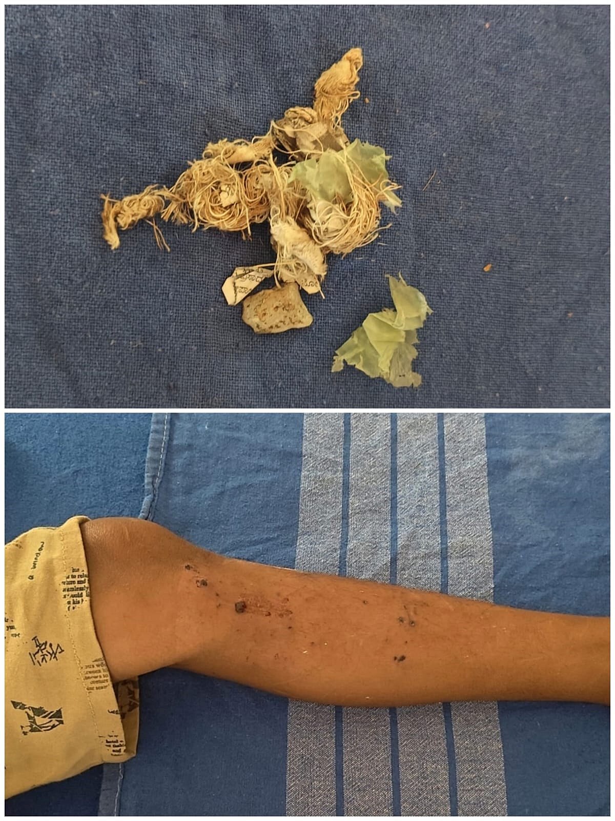 ಬೆಳ್ತಂಗಡಿ| ಚೆಂಡಿನಂಥ ವಸ್ತು ಸ್ಪೋಟ: ಬಾಲಕನಿಗೆ ಗಾಯ