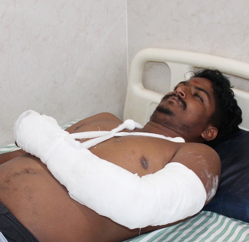 ಕಲ್ಲು ತೂರಾಟ | ಬೆನ್ನತ್ತಿದ ಪೊಲೀಸ್: ಬಿದ್ದು ಕೈ ಮುರಿದುಕೊಂಡ ಯುವಕ