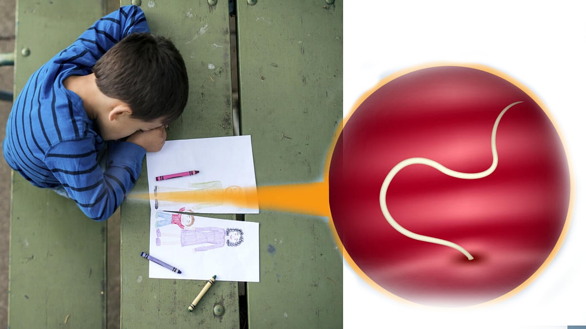 ಮಕ್ಕಳಿಗೆ ಕಾಡುವ ಜಂತು ಹುಳುಗಳು: ಪರಿಹಾರ ಕ್ರಮಗಳಿವು