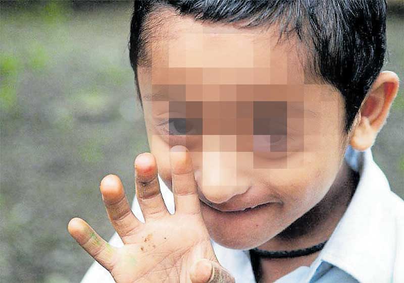 ಡೌನ್ಸ್‌ ಸಿಂಡ್ರೋಮ್‌ ಗರ್ಭಪಾತಕ್ಕೆ ಕಾರಣವಲ್ಲ