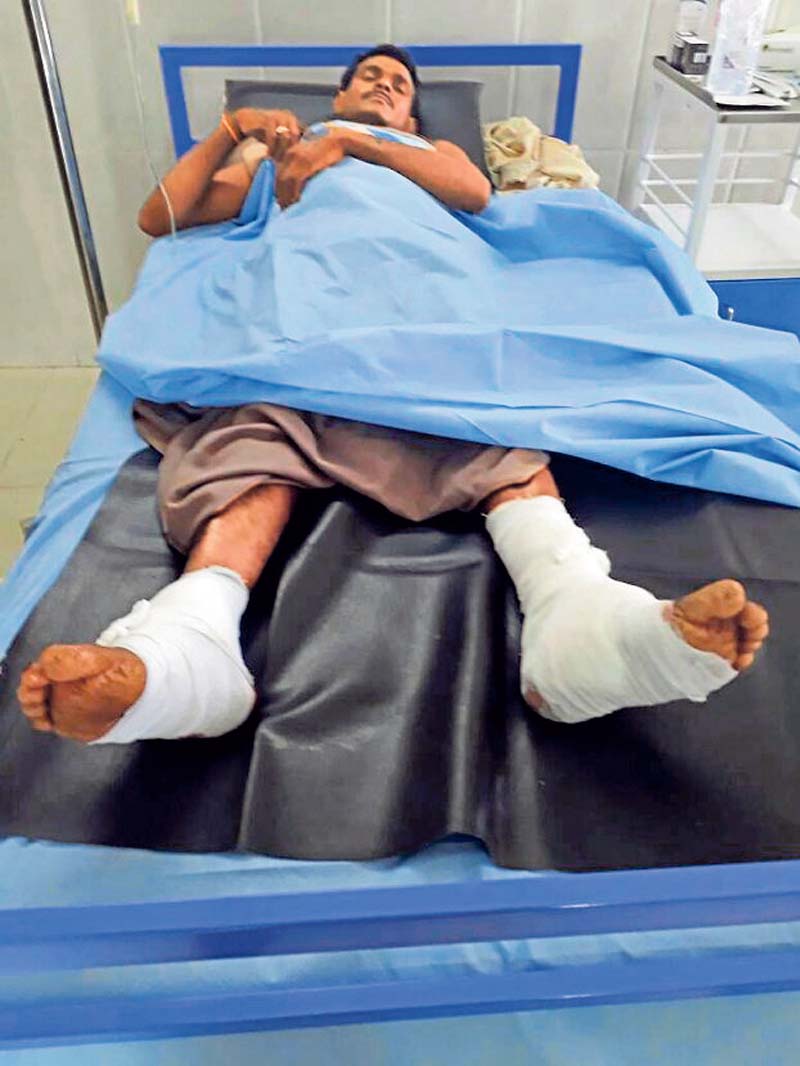 ಮೊಸಳೆ ದಾಳಿ: ಗಾಯ