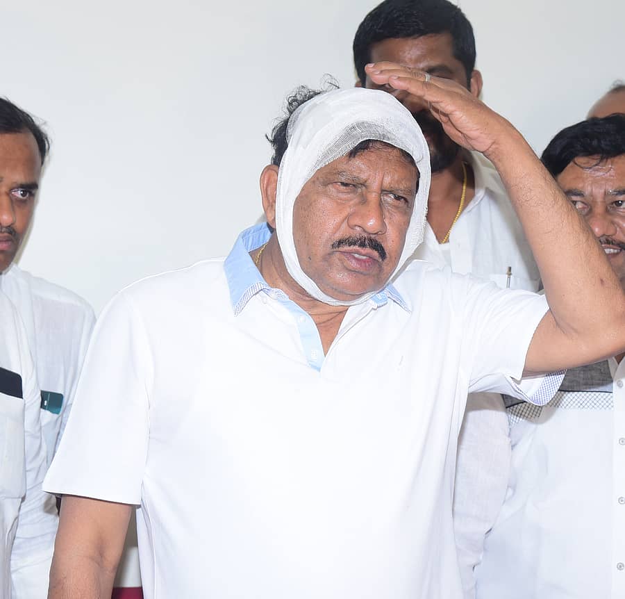 ಪತ್ರಿಕಾಗೋಷ್ಠಿಯಲ್ಲಿ ತಲೆಗಾದ ಗಾಯ ತೋರಿಸಿದ ಡಾ.ಜಿ.ಪರಮೇಶ್ವರ