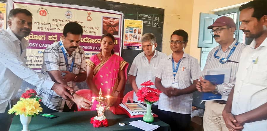ಶ್ರೀರಂಗಪಟ್ಟಣ ತಾಲ್ಲೂಕಿನ ದರಸಗುಪ್ಪೆ ಗ್ರಾಮದಲ್ಲಿ ತಾಲ್ಲೂಕು ಆರೋಗ್ಯಾಧಿಕಾರಿಗಳ ಕಚೇರಿ ಸೋಮವಾರ ಏರ್ಪಡಿಸಿದ್ದ ‘ಕುಷ್ಠರೋಗ ಪ್ರಕರಣಗಳ ಪತ್ತೆ ಹಚ್ಚುವ ಅಭಿಯಾನ’ಕ್ಕೆ ತಾಲ್ಲೂಕು ಆರೋಗ್ಯಾಧಿಕಾರಿ ಡಾ.ಎನ್.ಕೆ. ವೆಂಕಟೇಶ್ ಚಾಲನೆ ನೀಡಿದರು. ಕ್ಷೇತ್ರ ಆರೋಗ್ಯ ಶಿಕ್ಷಣಾಧಿಕಾರಿ ಎಸ್.ಡಿ. ಬೆನ್ನೂರ ಇದ್ದಾರೆ