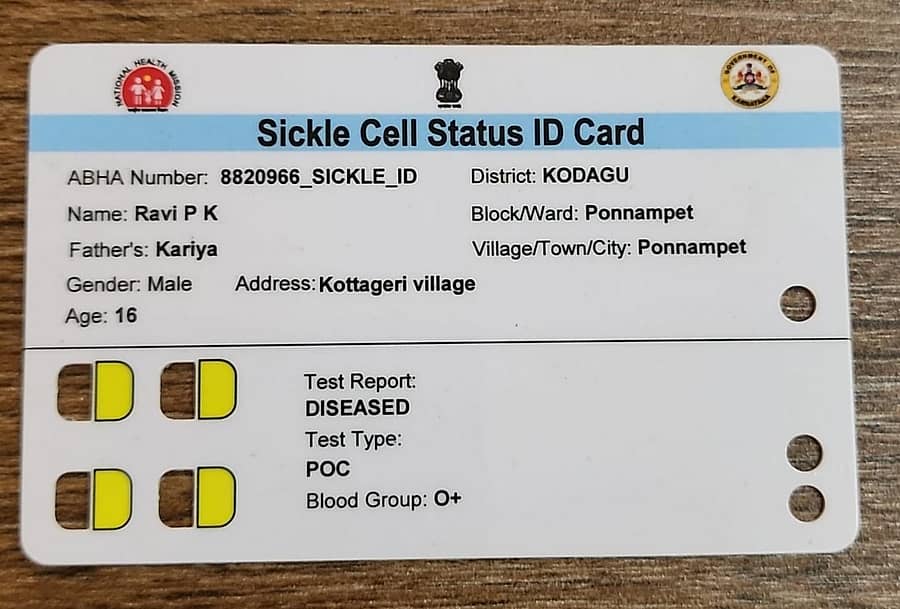 <div class="paragraphs"><p>‘ಕುಡುಗೋಲು ಕಣ ರಕ್ತಹೀನತೆ’ ಕಾಯಿಲೆ ದೃಢಪಟ್ಟವರಿಗೆ ಆರೋಗ್ಯ ಇಲಾಖೆಯಿಂದ ನೀಡಲಾಗುವ ವಿಶಿಷ್ಟ ಗುರುತಿನ ಚೀಟಿ</p></div>