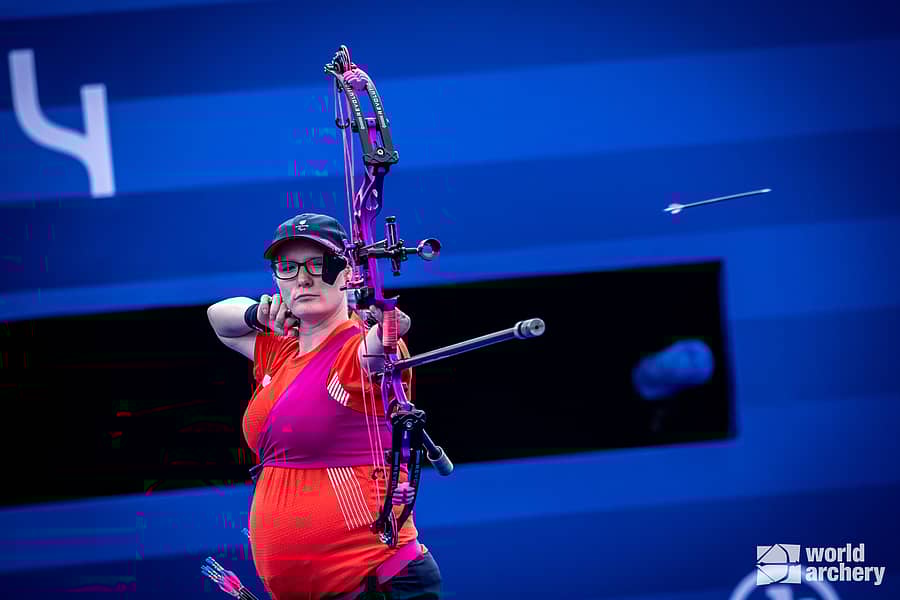 ಏಳು ತಿಂಗಳ ಗರ್ಭಿಣಿ ಜೋಡೆ ಗ್ರಿನ್ಹ್ಯಾಮ್–ಎಕ್ಸ್ ಚಿತ್ರ