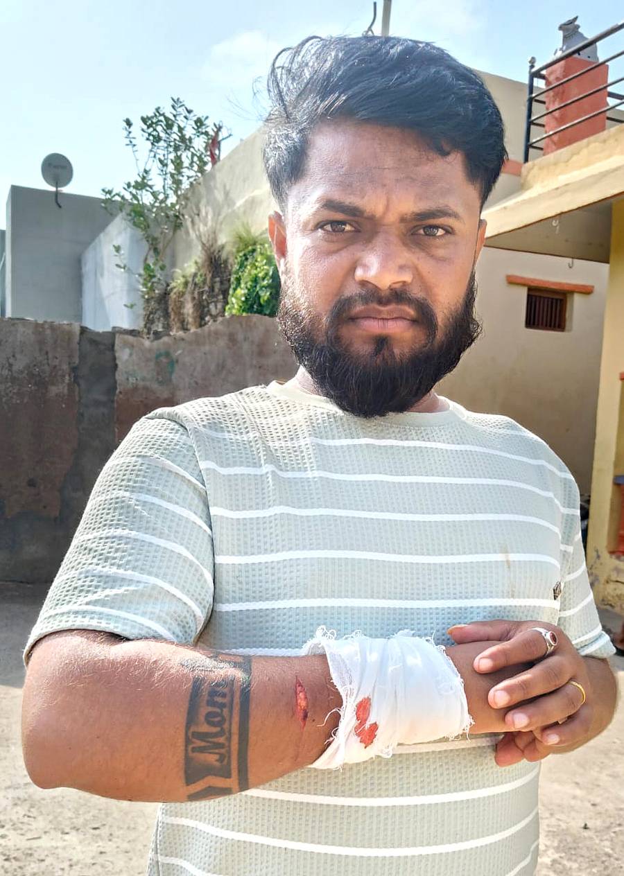 ಕಳ್ಳರಿಂದ ಚಾಕು ಇರಿತಕ್ಕೆ ಒಳಗಾದ ಲೋಕೇಶ ಬಸಪ್ಪ ದಳವಾಯಿ