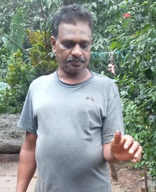 ಮೂಡಿಗೆರೆ ತಾಲ್ಲೂಕಿನ ಅಲೆಕಾನು ಗ್ರಾಮದಲ್ಲಿ ಕಾಡುಹಂದಿ ದಾಳಿಯಿಂದ ಉಪೇಂದ್ರ ಎಂಬುವರ ಕೈ ಬೆರಳು ಗಾಯವಾಗಿದೆ