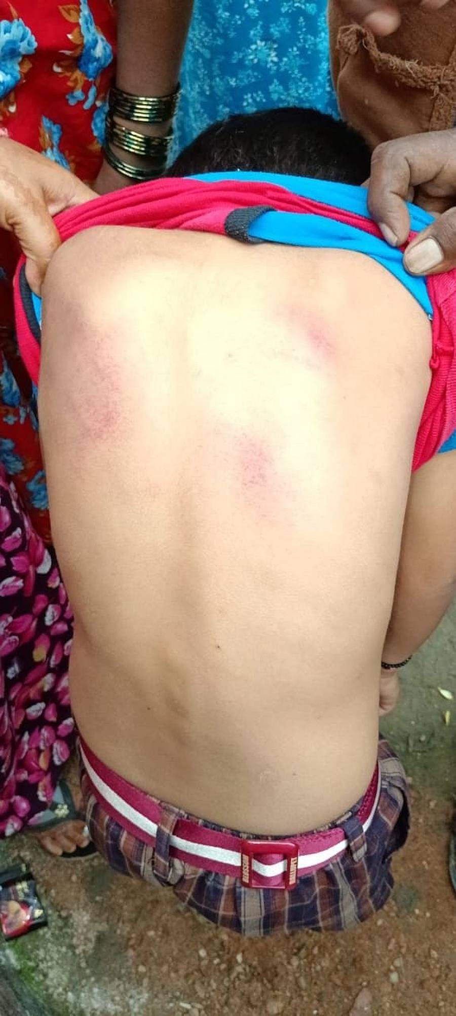 ಸಕಲೇಶಪುರ ತಾಲ್ಲೂಕಿನ ಬಾಳ್ಳುಪೇಟೆಯ ಬ್ಲಾಸಂ ಶಾಲೆಯ 1ನೇ ತರಗತಿ ವಿದ್ಯಾರ್ಥಿಗೆ ಶಿಕ್ಷಕಿ ಥಳಿಸಿರುವುದು