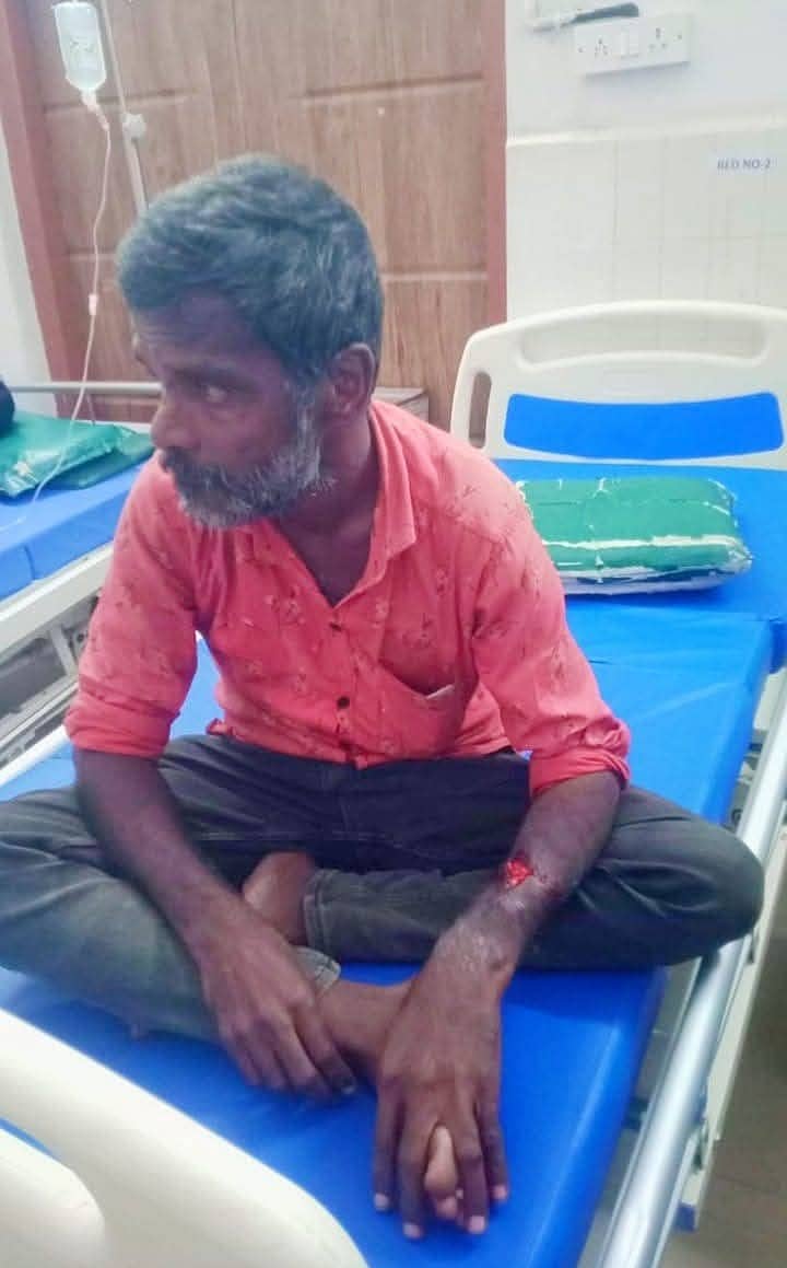 ಗುಂಡ್ಲುಪೇಟೆ ಪಟ್ಟಣದ ಹೊರ ವಲಯದಲ್ಲಿ ಹುಚ್ಚುನಾಯಿ ದಾಳಿಯಿಂದ ಗಾಯಗೊಂಡ ವ್ಯಕ್ತಿ ಮೈಸೂರಿನ ಖಾಸಗೀ ಆಸ್ಪತ್ರೆಯಲ್ಲಿ ಚಿಕಿತ್ಸೆ ಪಡೆಯುತ್ತಿದ್ದಾರೆ.