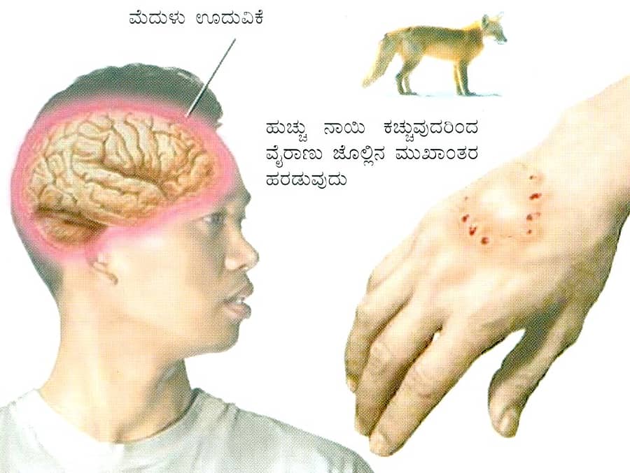 ರೇಬಿಸ್‌ ವೈರಾಣು ಹರಡುವ ಹಂತಗಳು