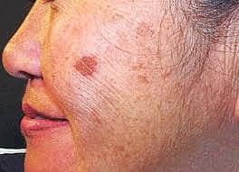 <div class="paragraphs"><p>ಪ್ರಜಾವಾಣಿ ಚಿತ್ರ</p></div>