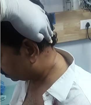 ಗುಂಡಿನ ದಾಳಿಯಿಂದ ಗಾಯಗೊಂಡಿರುವ ರಾಜಗೋಪಾಲ್