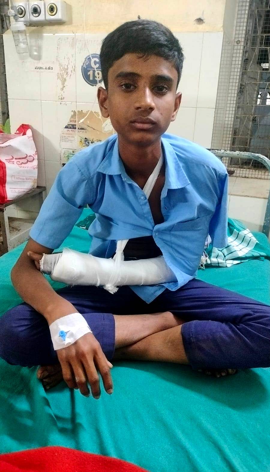 ರೇಖಲಗೆರೆ ಸರ್ಕಾರಿ ಪ್ರೌಢಶಾಲೆಯ ಅಜಯ್ಯ ಎಂಬ 10ನೇ ತರಗತಿ ವಿದ್ಯಾರ್ಥಿ ಕೈಮೂಳೆ ಅಪಘಾತದಲ್ಲಿ ಮುರಿದಿರುವುದು.