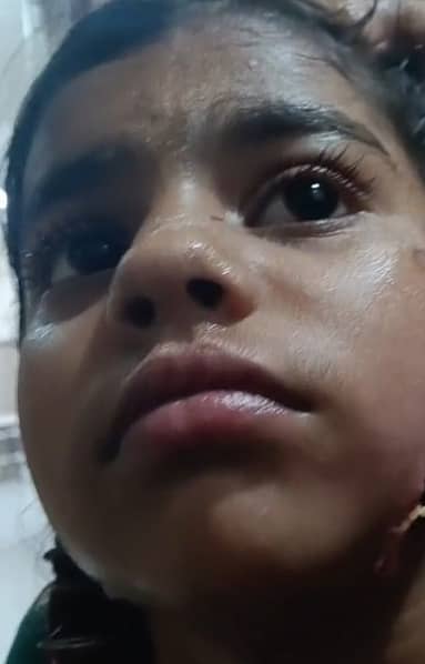 ಬೀದಿನಾಯಿ ದಾಳಿಗೊಳ್ಳಗಾಗಿರುವ ಉಮೇ  ಕುಲ್ಸುಮ್