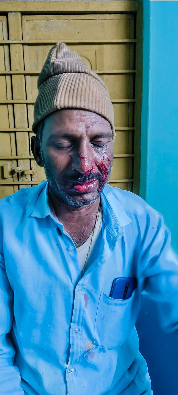 ಗುಂಡ್ಲುಪೇಟೆ ತಾಲ್ಲೂಕಿನ ಬೊಮ್ಮನಹಳ್ಳಿ ಗ್ರಾಮದ ರೈತ ರಾಜಶೇಖರಪ್ಪ ಚಿರತೆ ದಾಳಿಯಿಂದ ಗಾಯಗೊಂಡಿರುವುದು