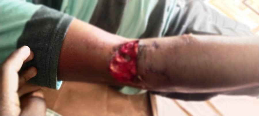 ಬಂಟ್ವಾಳ ತಾಲ್ಲೂಕಿನ ರಾಯಿ ಸಮೀಪದ ಕೈತ್ರೋಡಿ ಎಂಬಲ್ಲಿ ಮೀಟರ್ ರೀಡರ್ ಸಂಪತ್ ಎಂಬುವರಿಗೆ ನಾಯಿ ಕಡಿದು ಗಂಭೀರ ಗಾಯವಾಗಿದೆ