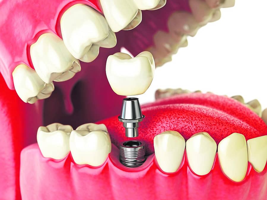 <div class="paragraphs"><p>ದಂತ ಚಿಕಿತ್ಸೆ</p></div>