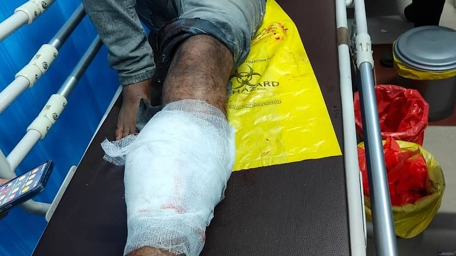 <div class="paragraphs"><p>ಗುಂಡೇಟಿನಿಂದ ಗಾಯಗೊಂಡ ರೌಡಿಶೀಟರ್ </p></div>