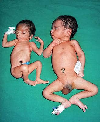 ತ್ವರಿತ ಆಗಮನ...ಬಹು ಸಂಕೀರ್ಣ!